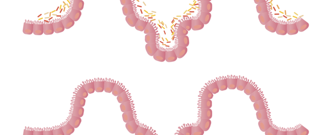 Do I have leaky gut?