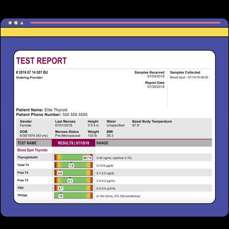 Complete thyroid panel illustration
